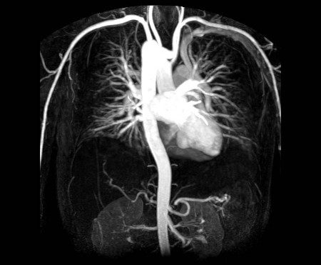 Lab test image of MRI Cardiac Angiography