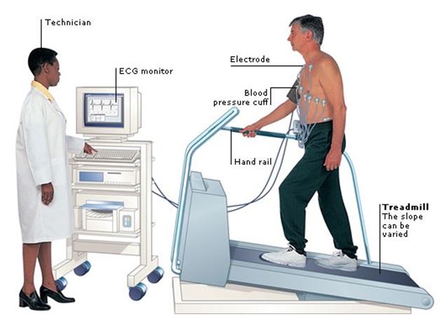 Lab test image of TMT (Treadmill Test)